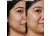 SERUM GLOW RECIPE 40ML-WATERMELON GLOW NIACINAMIDE SERUM GLOW RECIPE 40ML-WATERMELON GLOW NIACINAMIDE